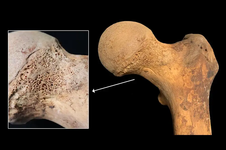 An image of a bone with a hole in it.
